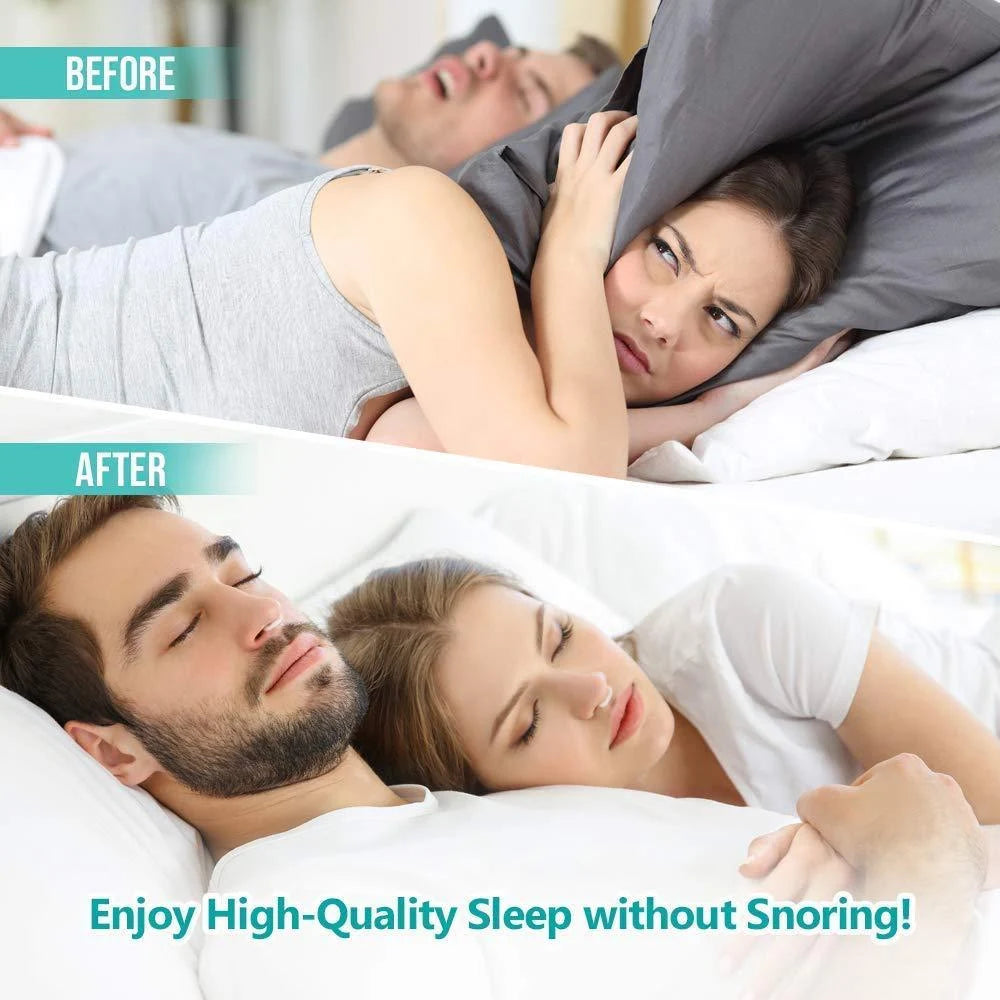 2/4 PCs Magnetic Anti Snoring Device