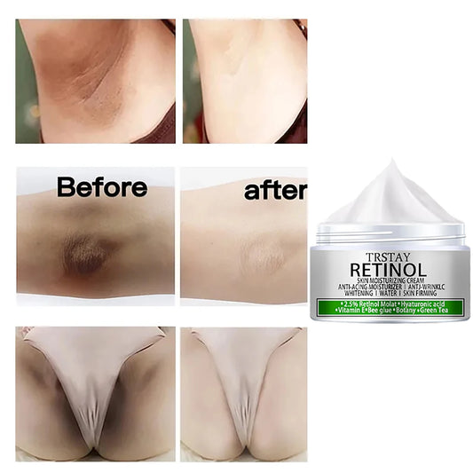 Whitening Cream Private Parts