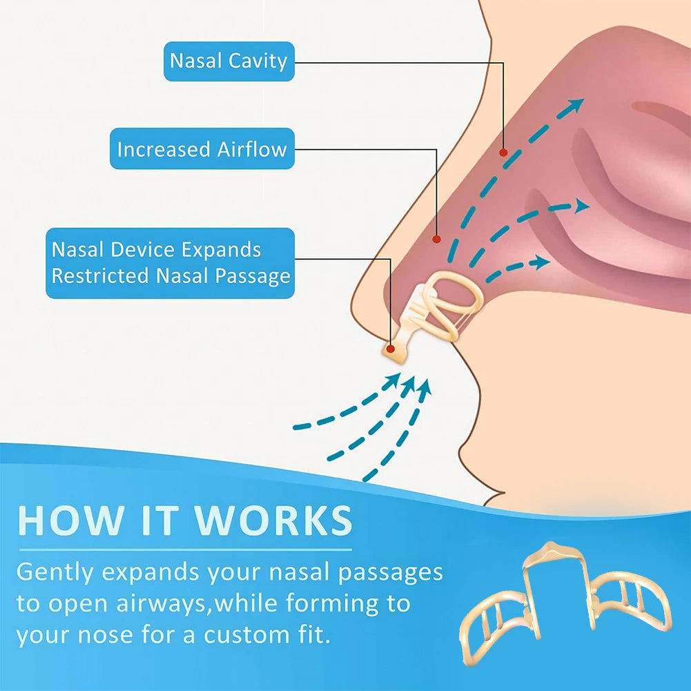 Increases Airflow Anti Snoring Devices Improve Sleep&Snoring