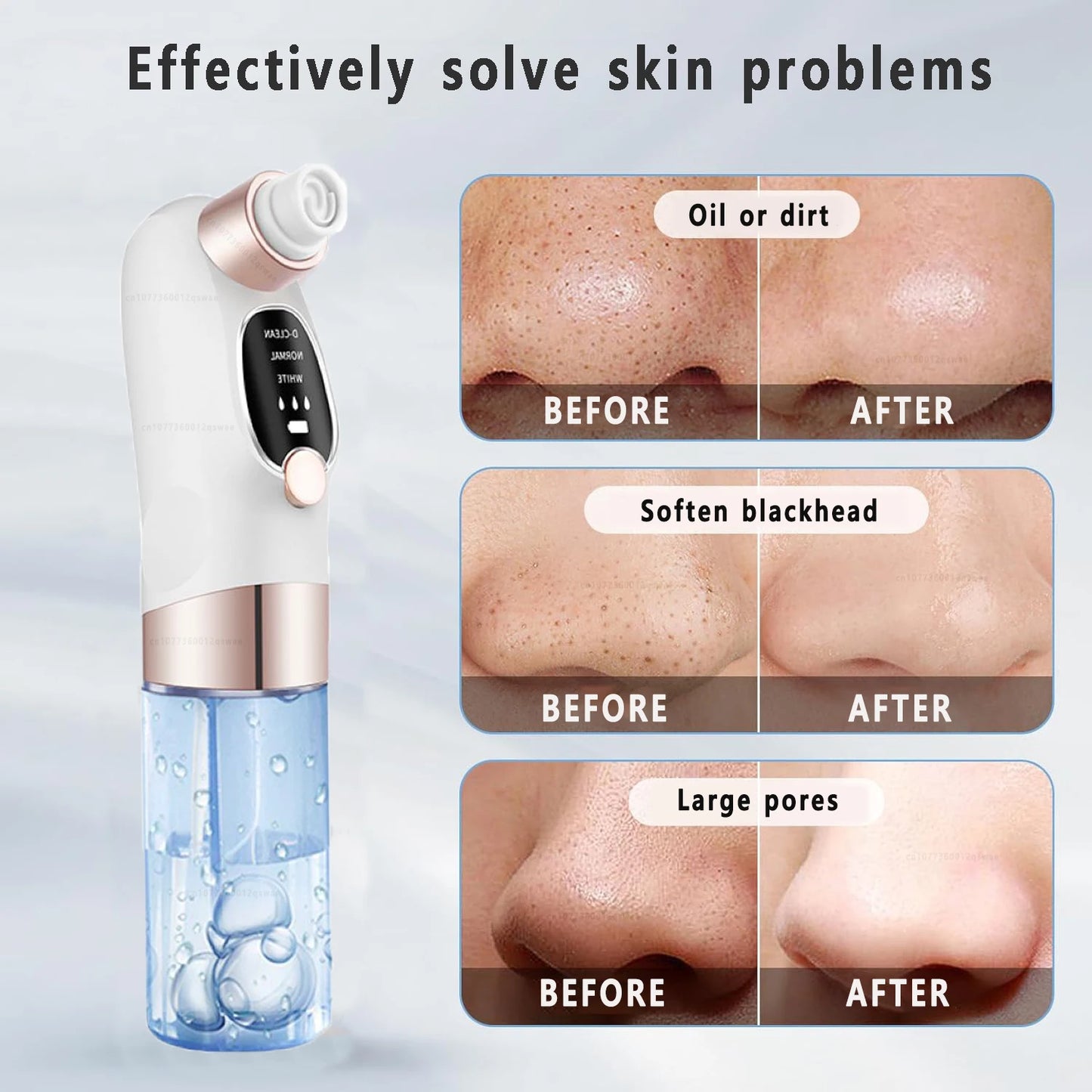 Blackhead Remover Pore Vacuum Face Cleaner Electric