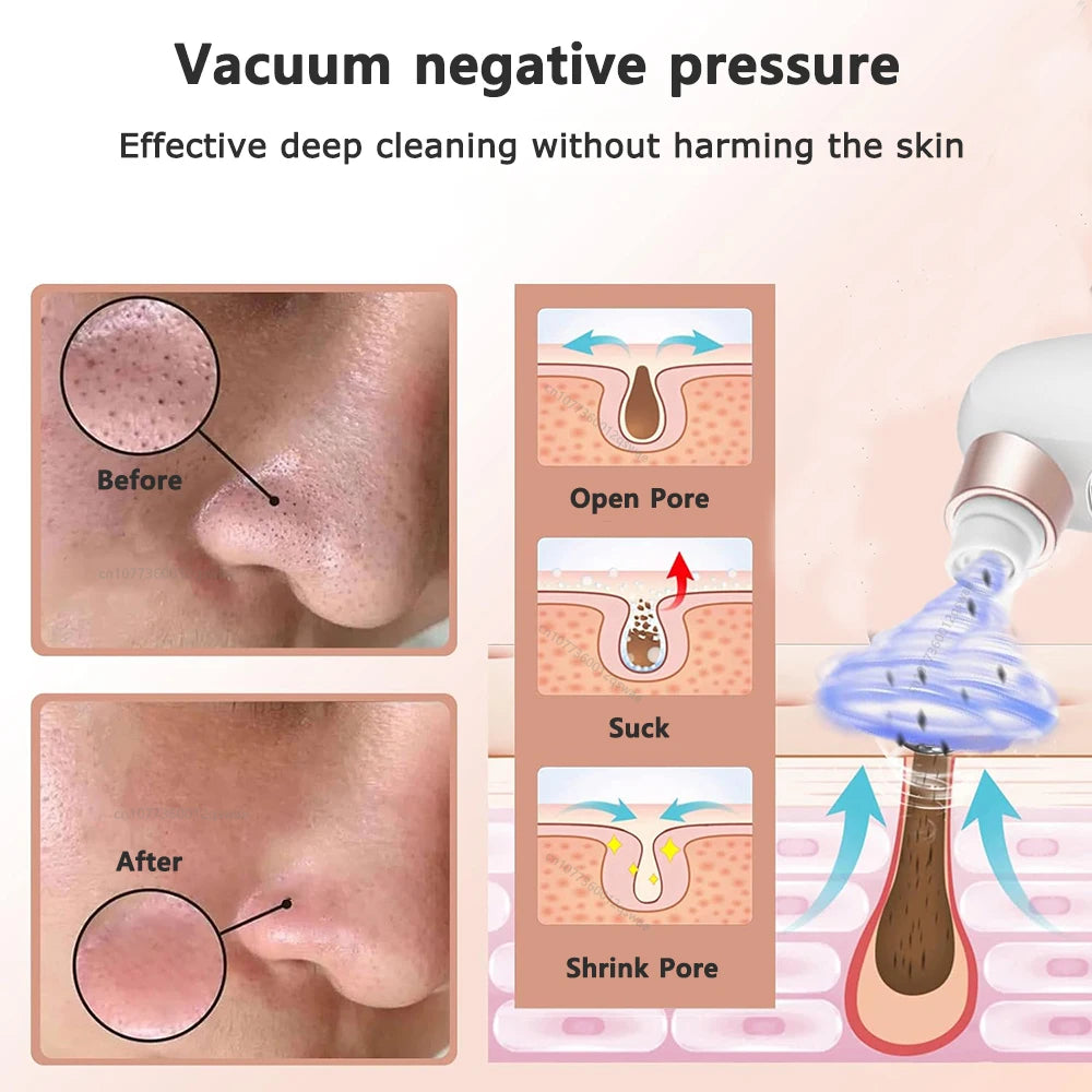 Blackhead Remover Pore Vacuum Face Cleaner Electric